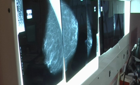 Mammográfiás szűrés márciusban